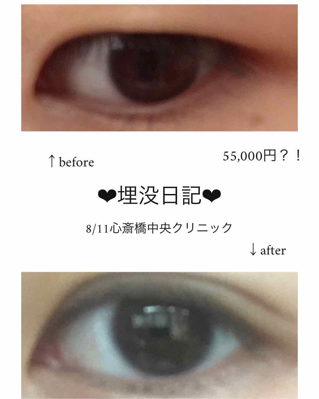 ã¿ãð± on LIPS ãâ€ïžäºéåæ²¡ã«ã€ããŠâ€ïžåããŸããŠâ€ïžã¿ããšç³ããŸãããããã..ãïŒ1æç®ïŒ