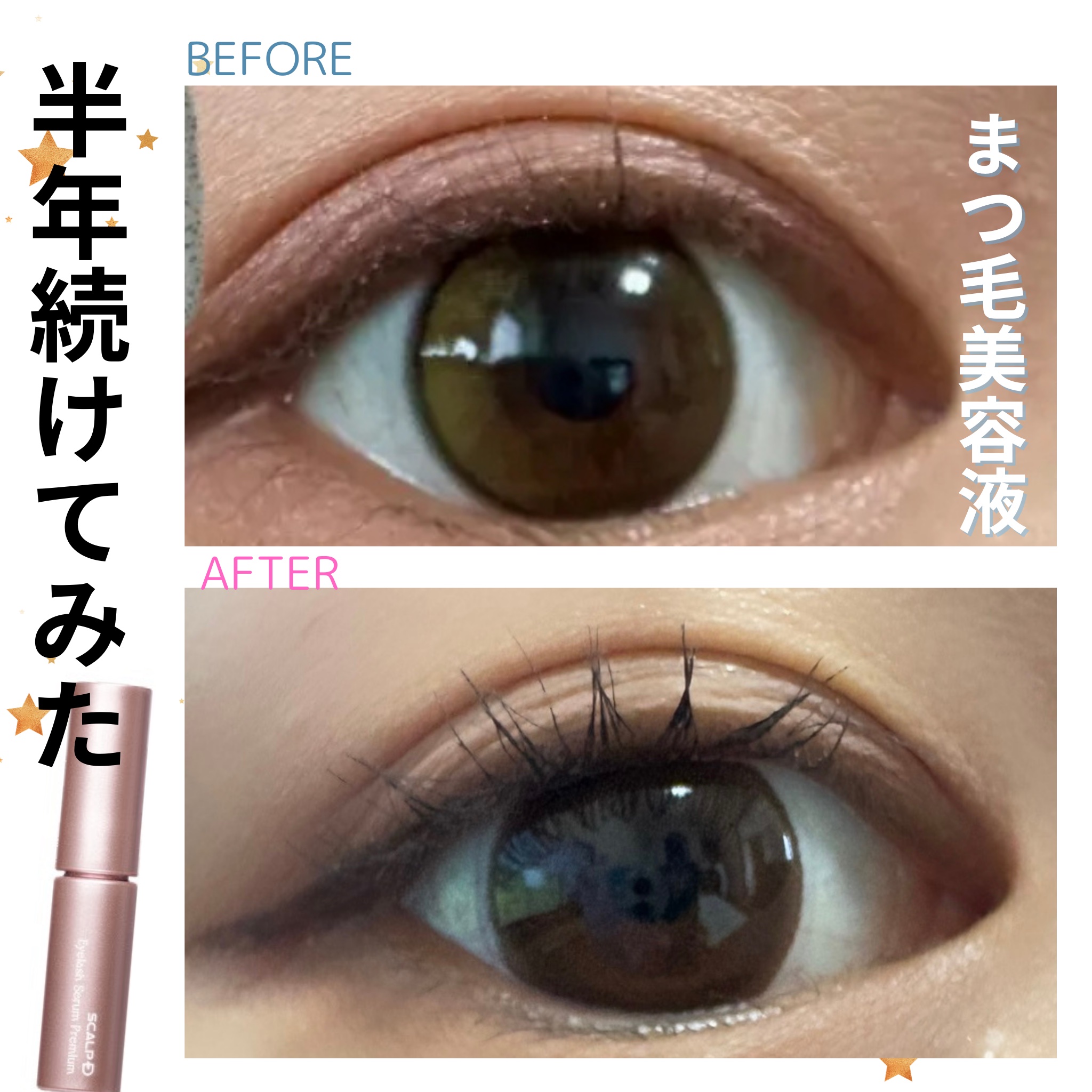 スカルプD アイラッシュセラム プレミアム/アンファー(スカルプD)/まつげ美容液を使ったクチコミ（1枚目）