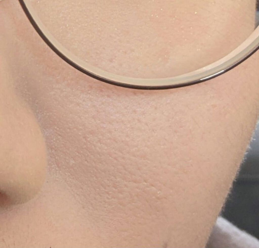 エッセンスローション/ヒフミド/化粧水を使ったクチコミ（2枚目）