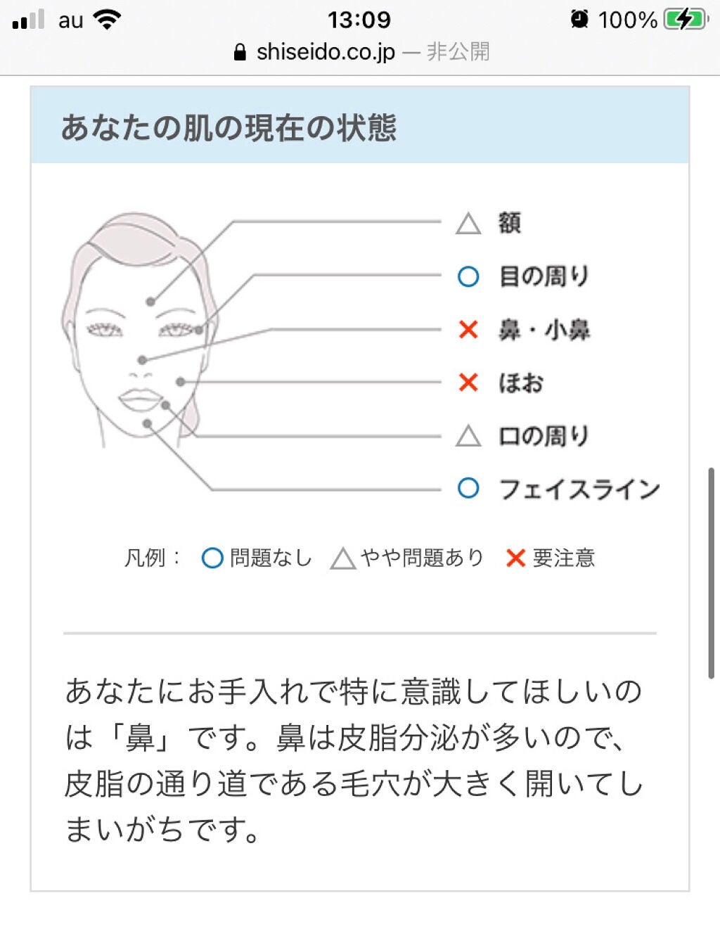 Rinka♧ on LIPS 「【肌質が分からない!そんな時は…?診断してみました。】 ..」(9枚目)