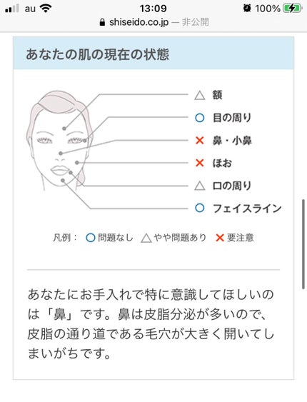 Rinka♧ on LIPS 「【肌質が分からない!そんな時は…?診断してみました。】 ..」(9枚目)