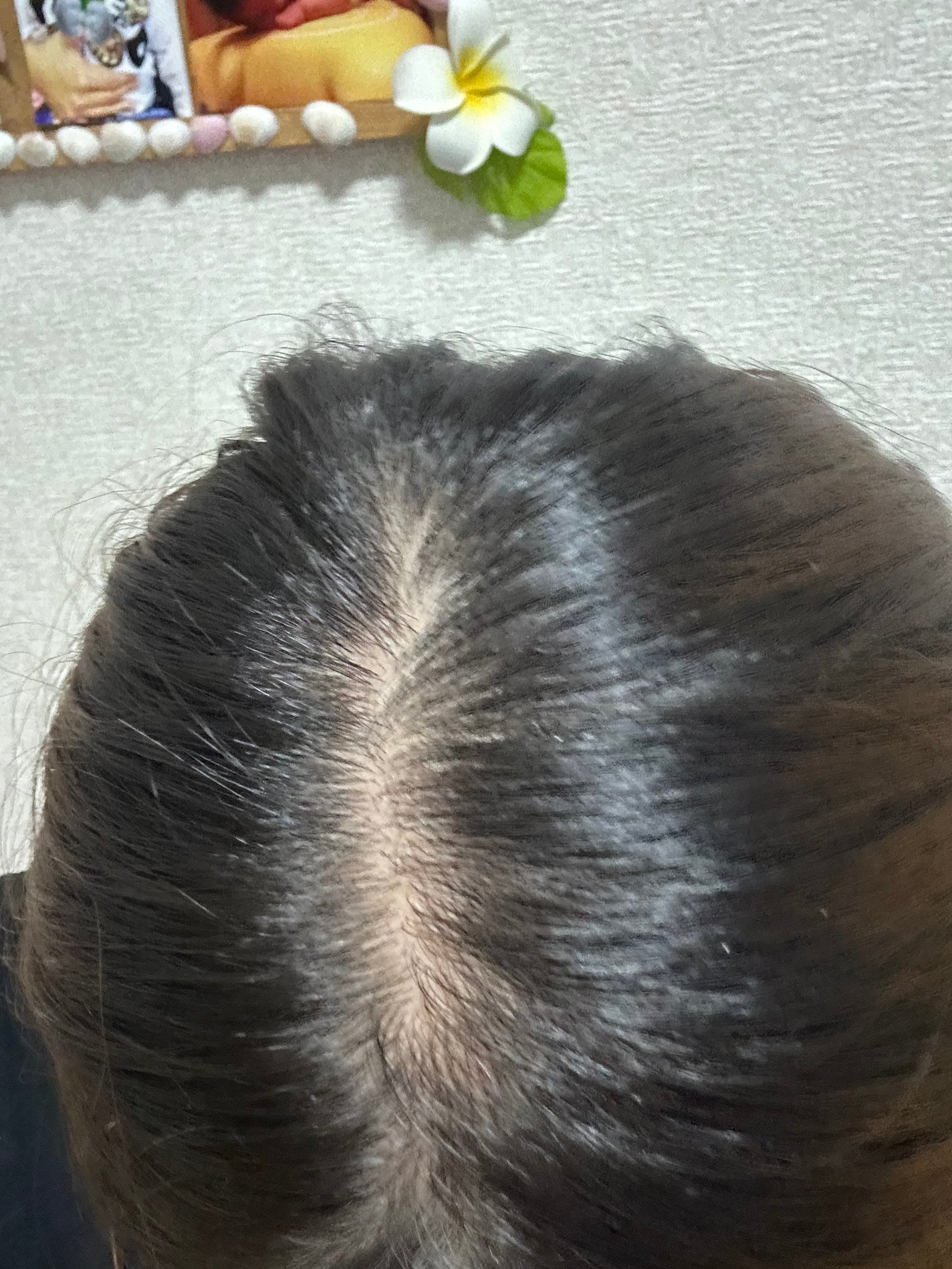 スカルプローション/Rintor/頭皮ローションを使ったクチコミ(4枚目)