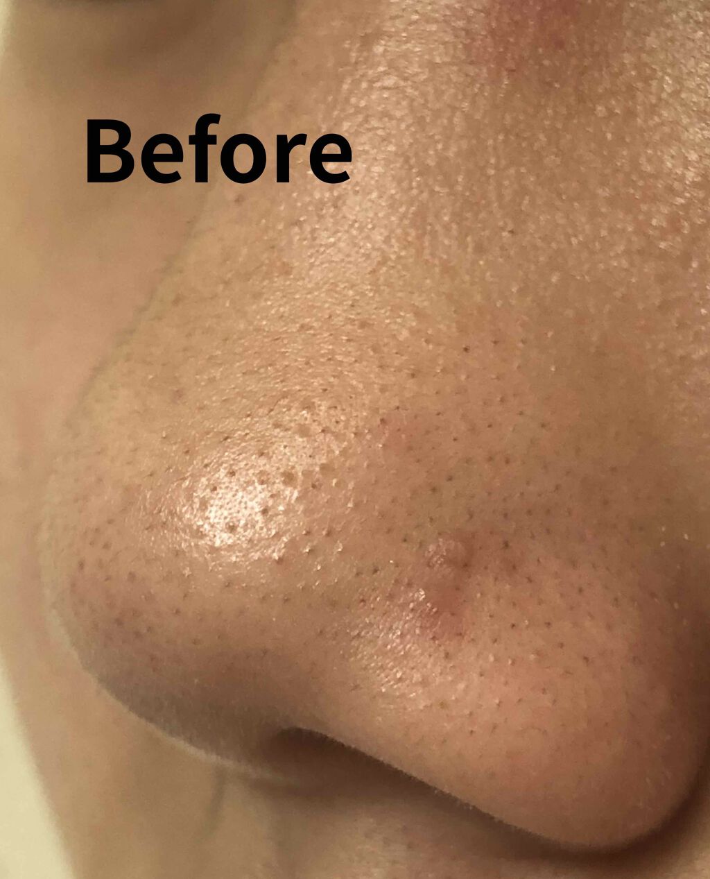 フェイスピーリングジェル ピーチの香り/DAISO/ピーリングを使ったクチコミ（1枚目）