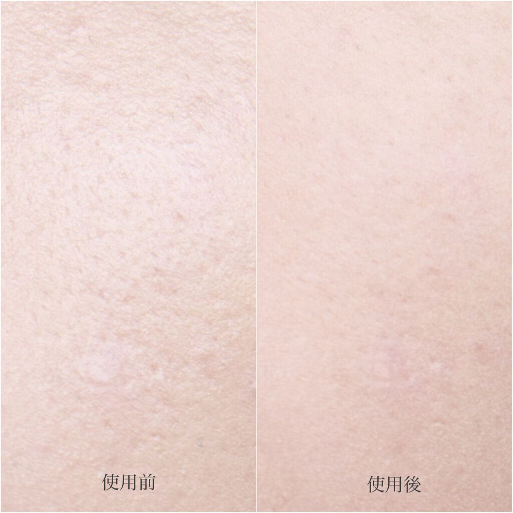 ルースセッティングパウダー トランスルーセント/ローラ メルシエ/ルースパウダーを使ったクチコミ(6枚目)