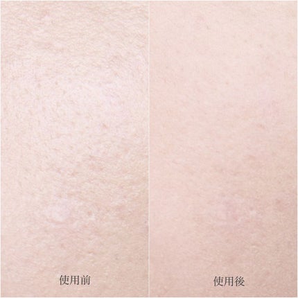 ルースセッティングパウダー トランスルーセント/ローラ メルシエ/ルースパウダーを使ったクチコミ(6枚目)