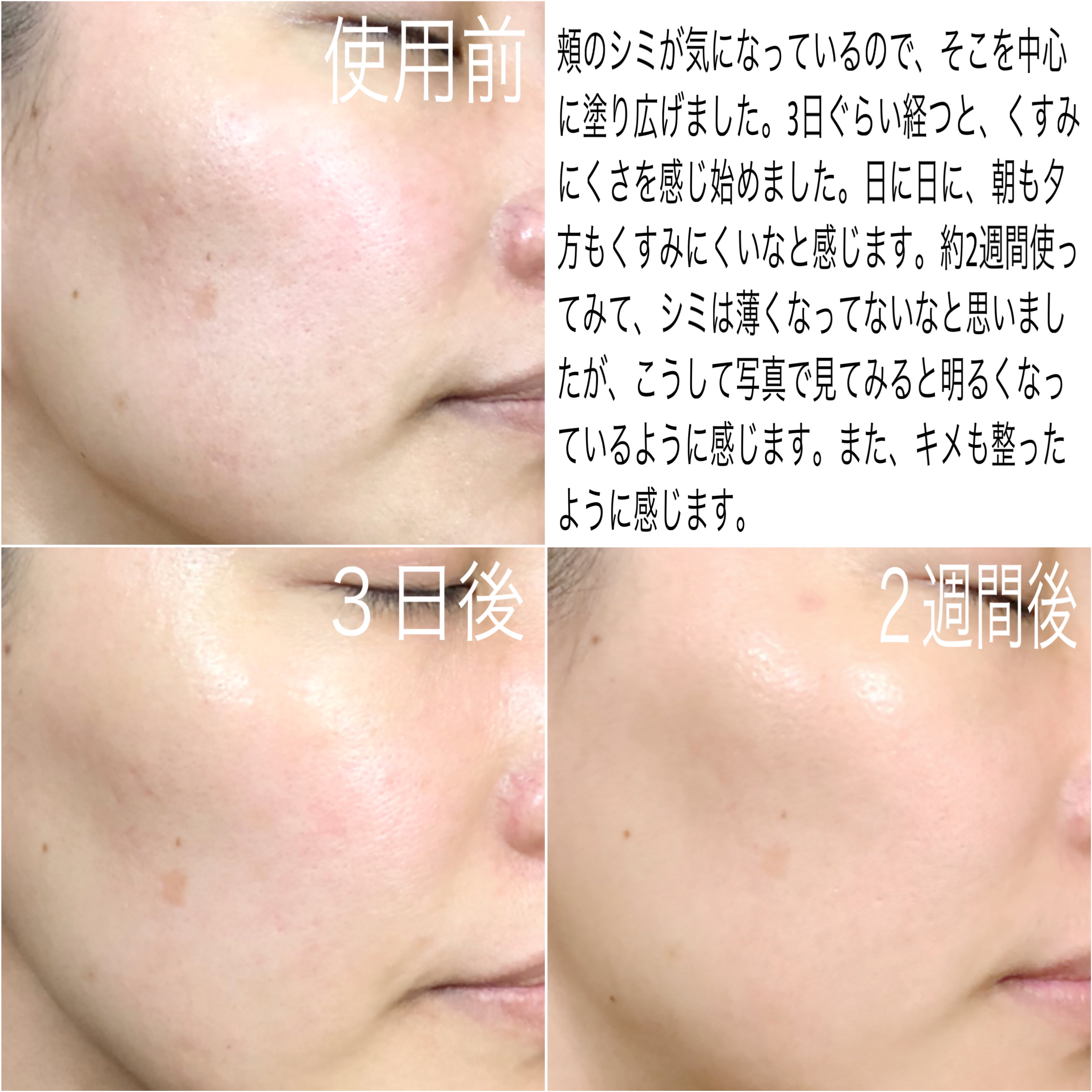 TXトーニングエッセンス1000SHOT/VT/美容液を使ったクチコミ（3枚目）