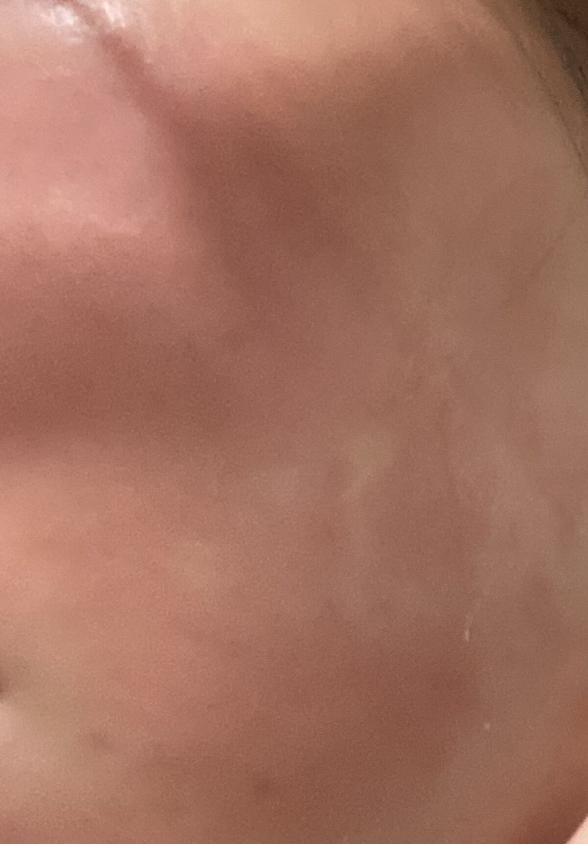 レチノールA 1% アドバンスドリバイタリゼーションクリーム/Life-flo/フェイスクリームを使ったクチコミ（2枚目）