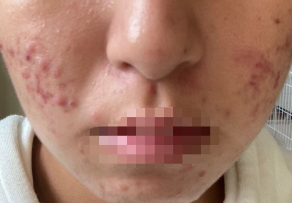 を使ったクチコミ（3枚目）