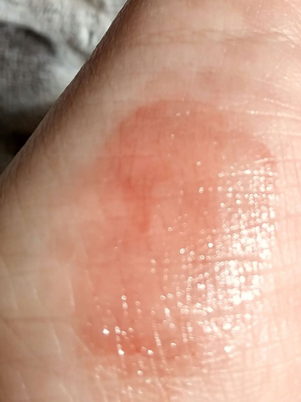 リップ&チーク ボーム N°1 ドゥ シャネル/CHANEL/口紅を使ったクチコミ(6枚目)