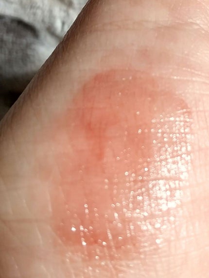 リップ&チーク ボーム N°1 ドゥ シャネル/CHANEL/口紅を使ったクチコミ(6枚目)