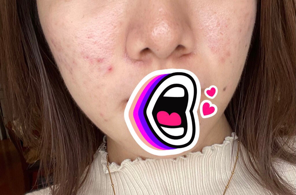 ザ・タイムR アクア/IPSA/化粧水を使ったクチコミ(1枚目)