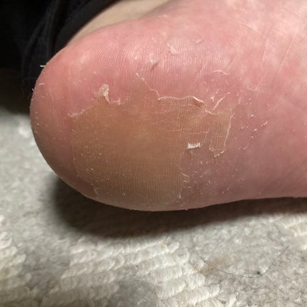 イージーパックDP60分タイプ/ベビーフット/レッグ・フットケアを使ったクチコミ(8枚目)