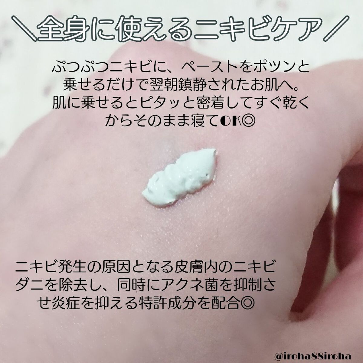 ミラクルアクネクリアスポットトリートメント/SOME BY MI/美容液を使ったクチコミ（2枚目）