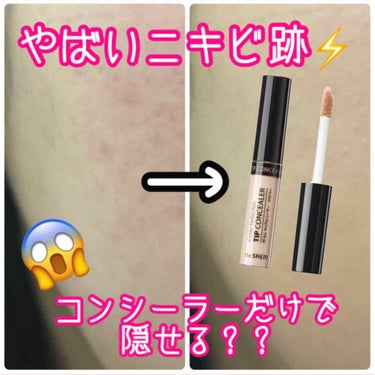 カバーパーフェクション チップコンシーラー/the SAEM/リキッドコンシーラーを使ったクチコミ（1枚目）