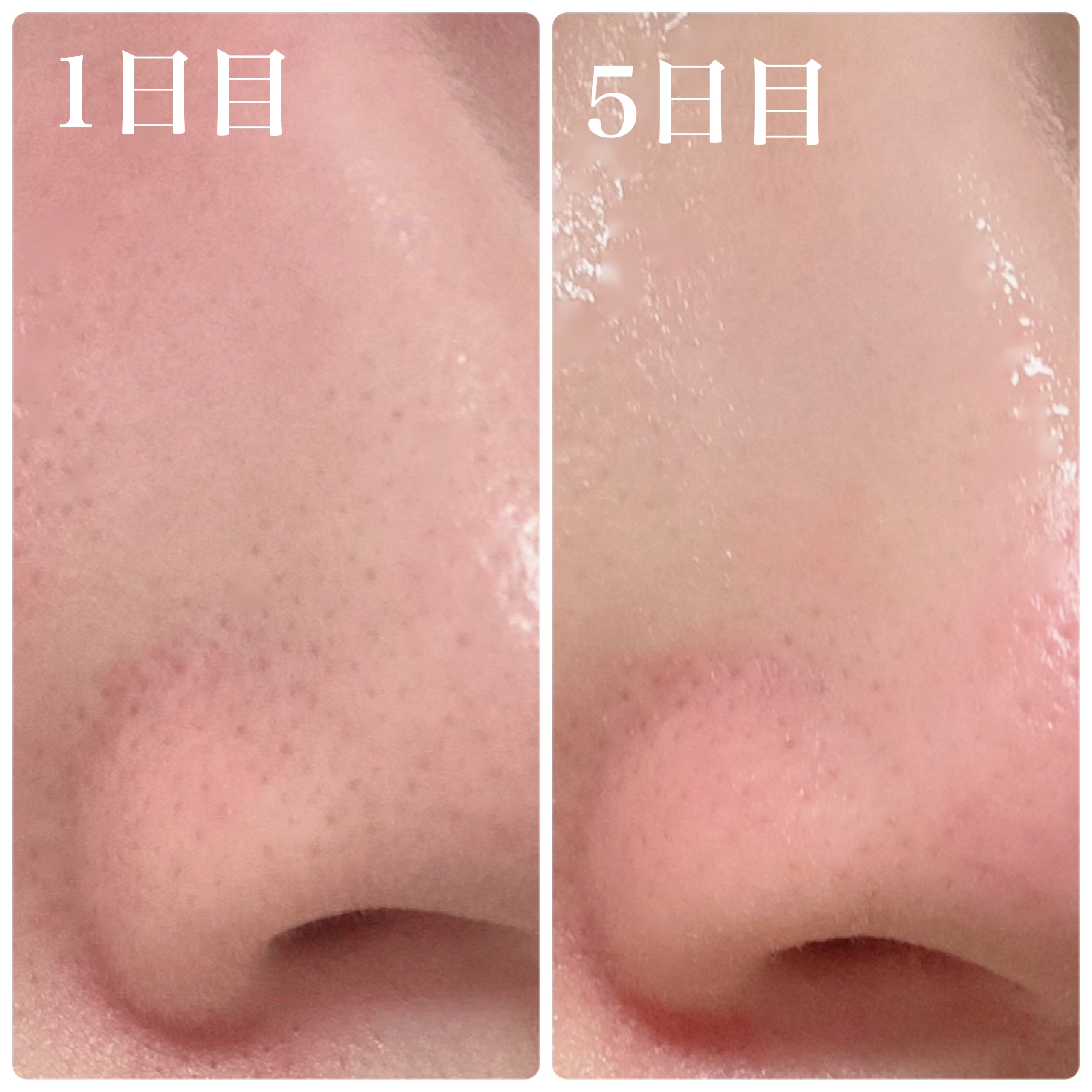 リードルショット1000/VT/ブースター・導入液を使ったクチコミ（3枚目）