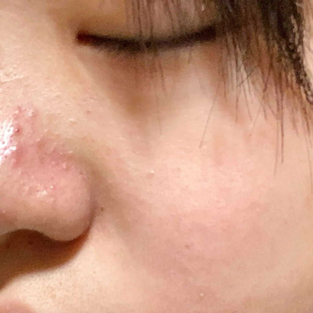 ハトムギ化粧水(ナチュリエ スキンコンディショナー R )/ナチュリエ/化粧水を使ったクチコミ（2枚目）