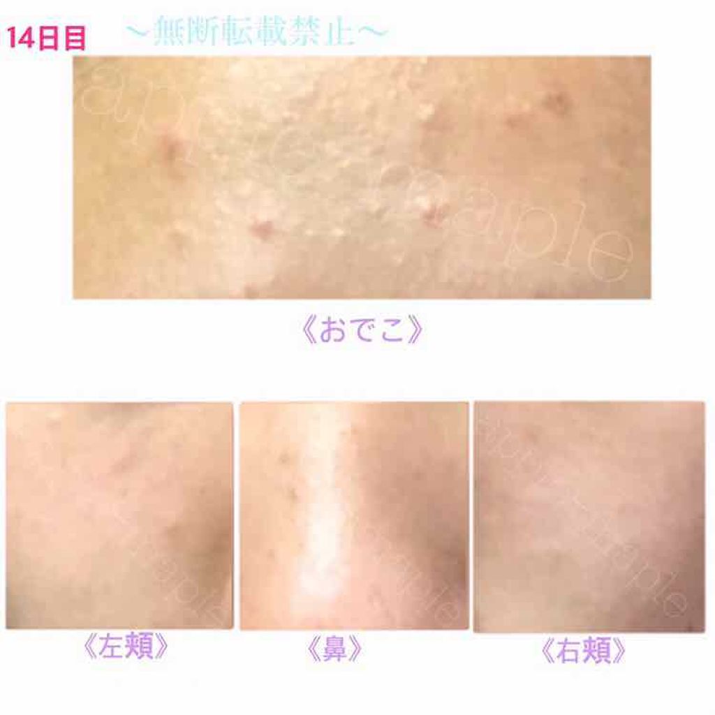 ロゼット 洗顔パスタ 荒性肌/ロゼット/洗顔フォームを使ったクチコミ(2枚目)