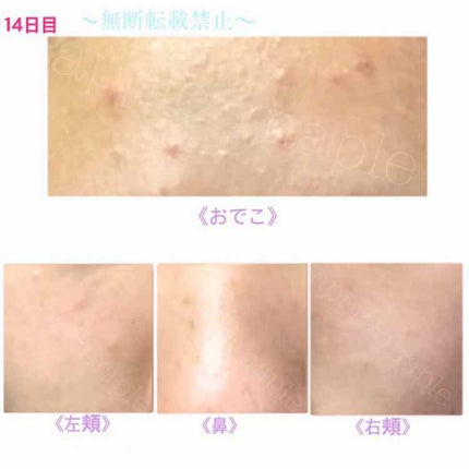 ロゼット 洗顔パスタ 荒性肌/ロゼット/洗顔フォームを使ったクチコミ(2枚目)