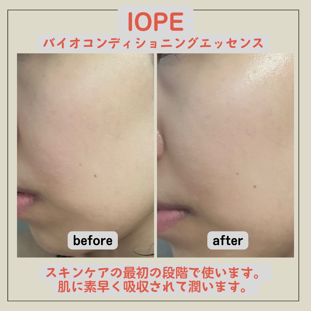 バイオ コンディショニング エッセンス/IOPE/ブースター・導入液を使ったクチコミ（3枚目）