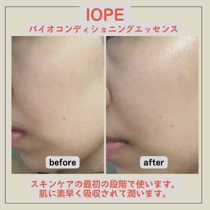 バイオ コンディショニング エッセンス/IOPE/ブースター・導入液を使ったクチコミ(3枚目)