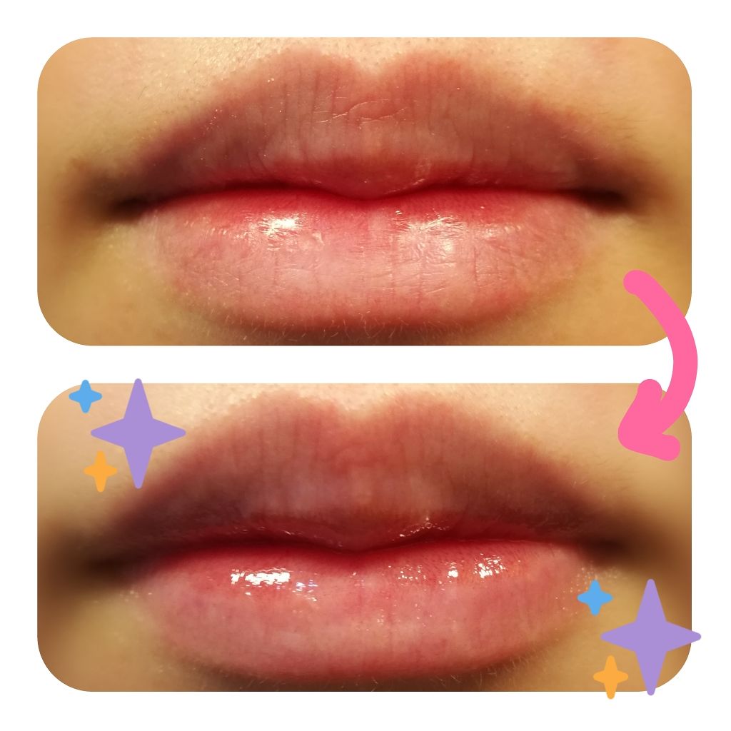 メルティクリームリップ/メンソレータム/リップクリームを使ったクチコミ（3枚目）