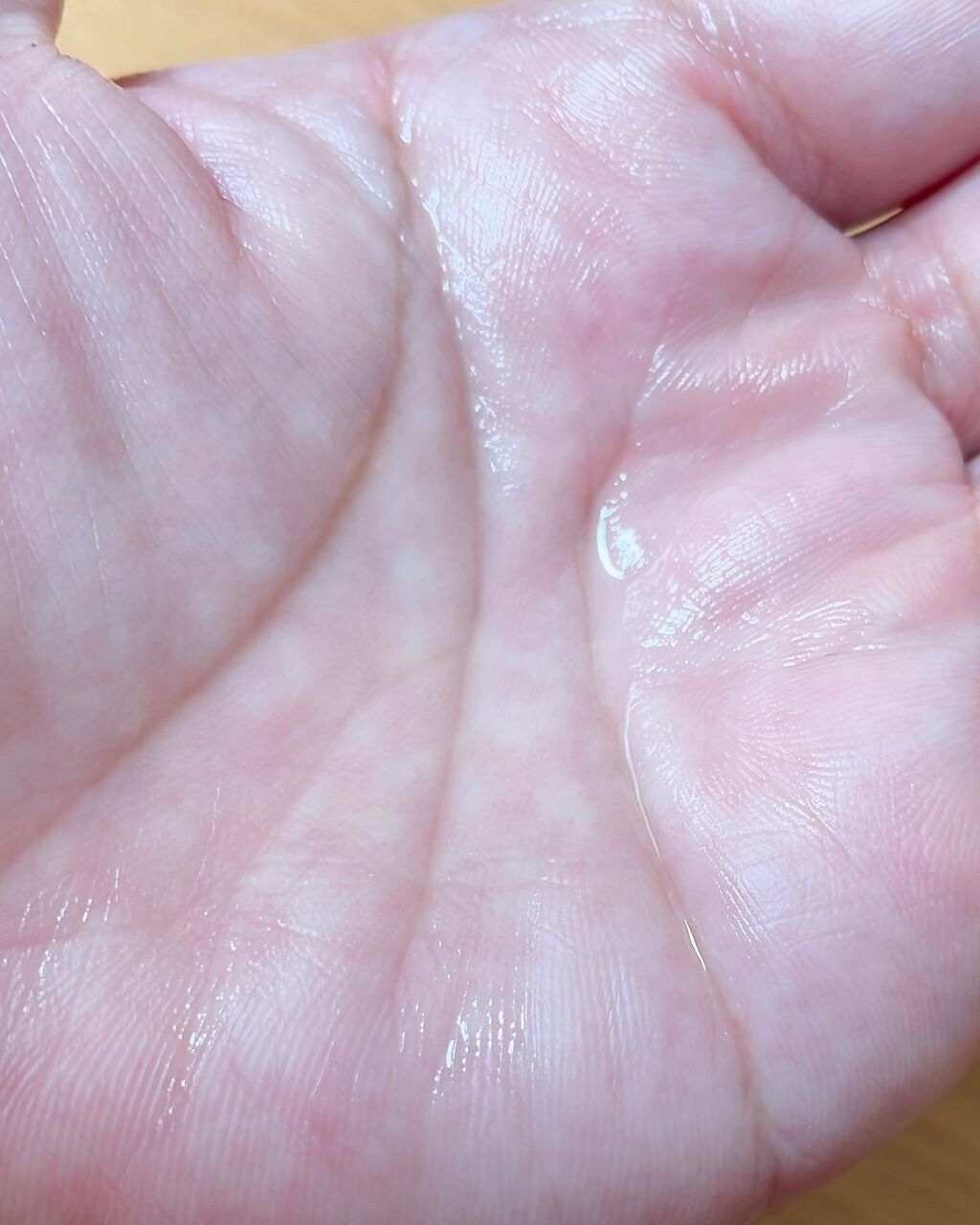 クリアフル ローションM(しっとりタイプ)/オルビス/化粧水を使ったクチコミ（2枚目）