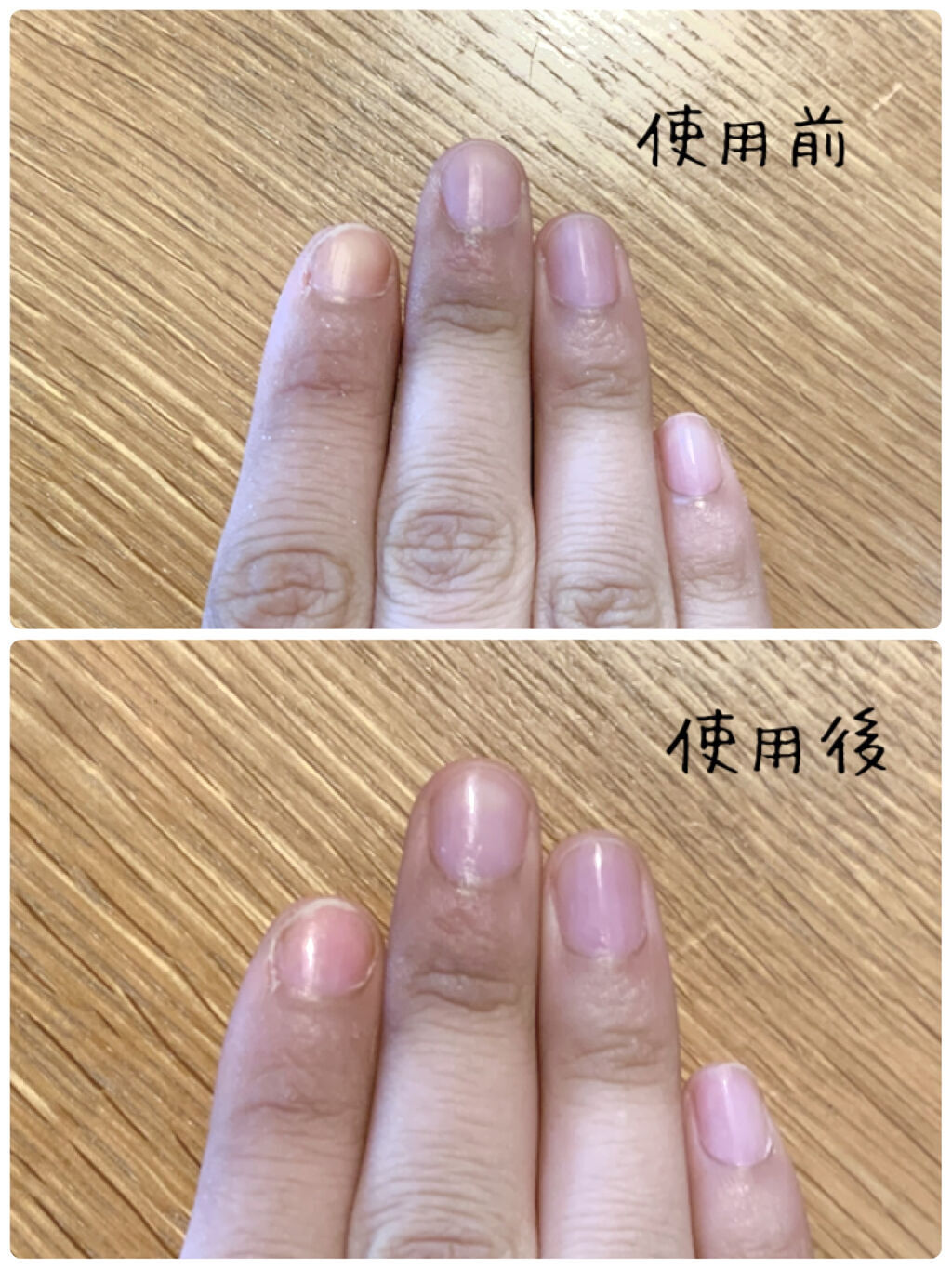 を使ったクチコミ（2枚目）