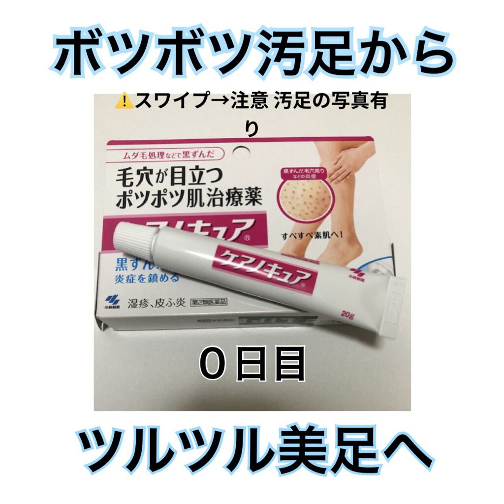 ケアノキュア（医薬品）/小林製薬/その他を使ったクチコミ（1枚目）