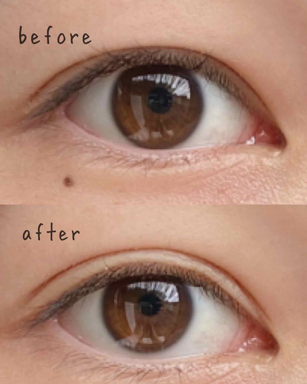 メザイク マットフィルム 皮膜タイプ/メザイク/二重まぶた用アイテムを使ったクチコミ（2枚目）