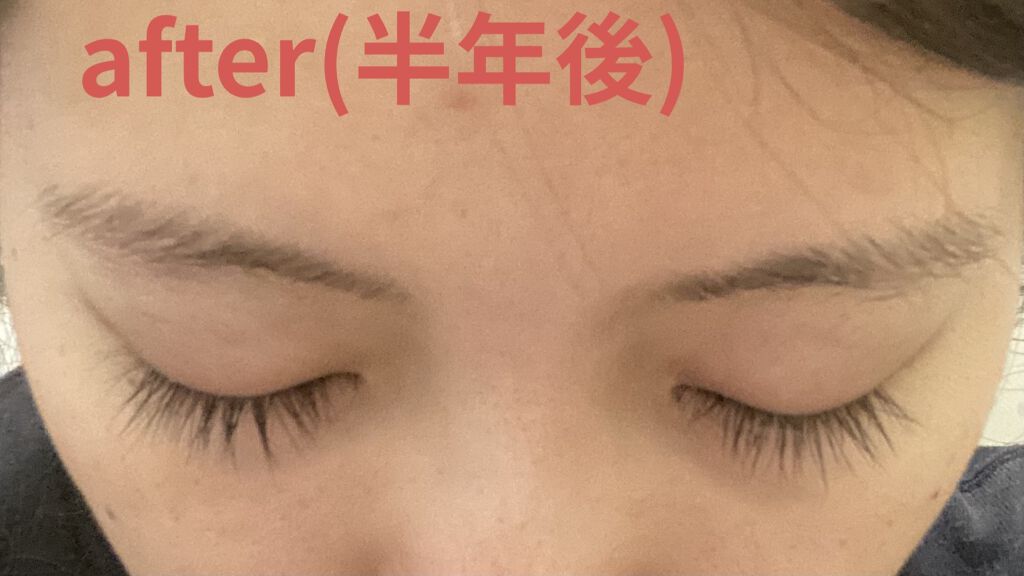 ラッシュアディクト アイラッシュコンディショニングセラム/soaddicted/まつげ美容液を使ったクチコミ（2枚目）