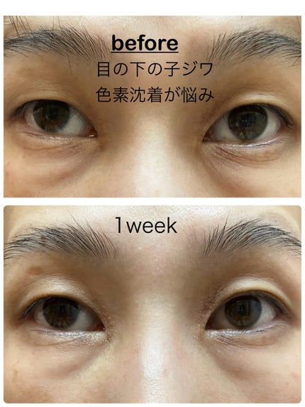 プラセホワイター 薬用美白アイクリーム/明色/アイケア・アイクリームを使ったクチコミ(4枚目)