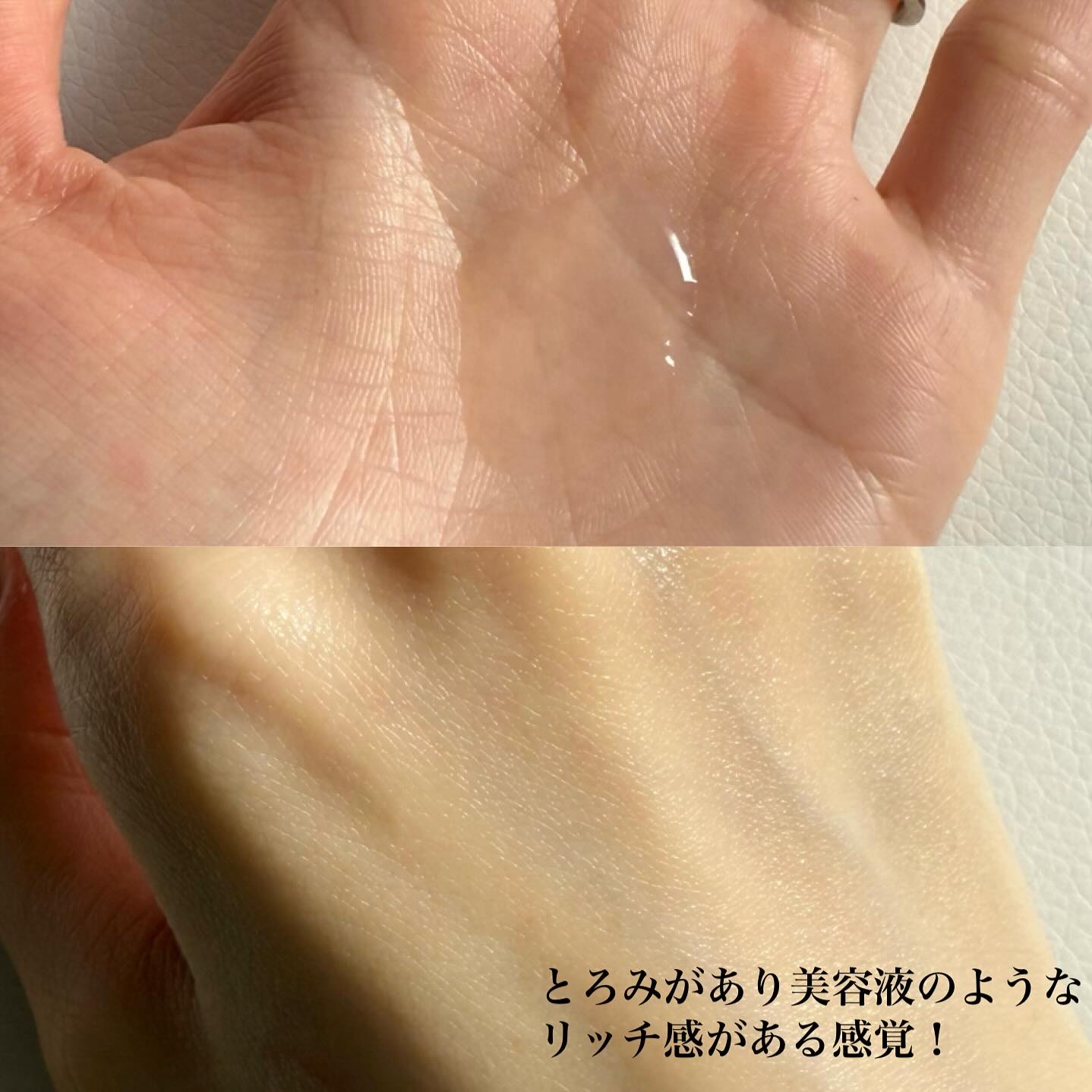 オイデルミン エッセンスローション/SHISEIDO/化粧水を使ったクチコミ（3枚目）