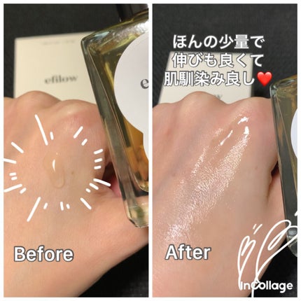 キメケア カバノアナタケバイオームアンプル/efilow/美容液を使ったクチコミ(8枚目)