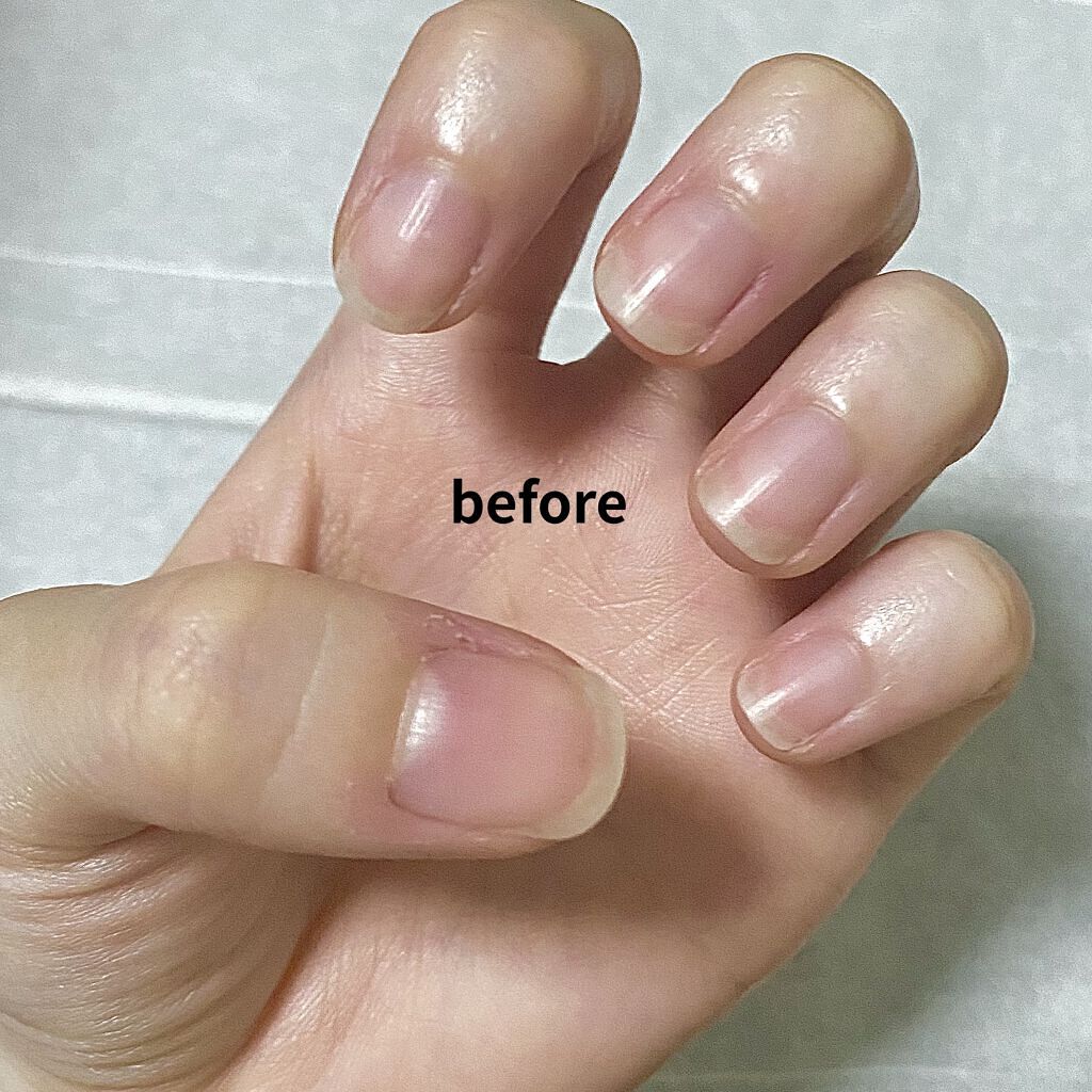 デイケアオイル/Dr.Nail/ネイルオイル・トリートメントを使ったクチコミ（2枚目）