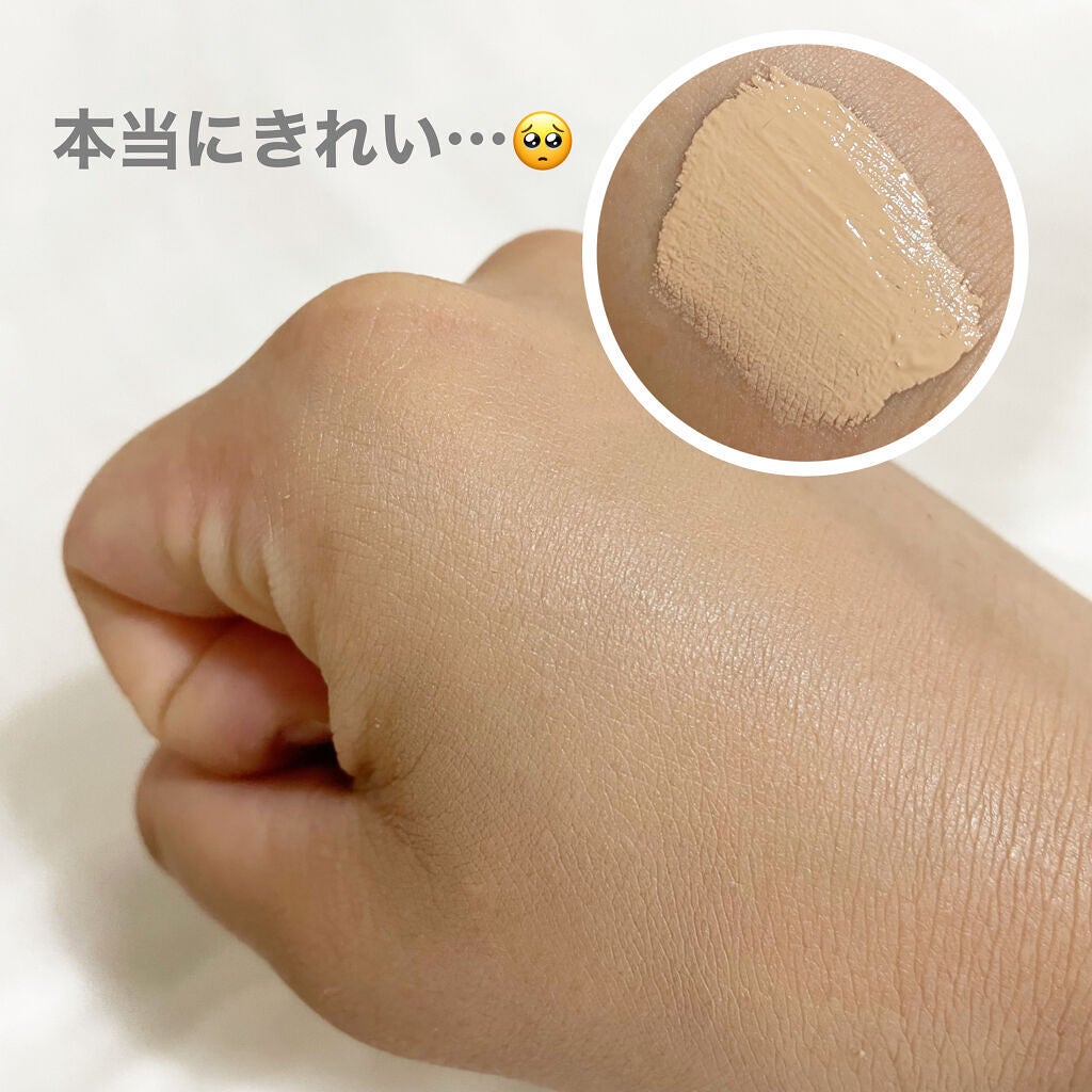 【旧】ディオールスキン フォーエヴァー スキン コレクト コンシーラー/Dior/リキッドコンシーラーを使ったクチコミ(4枚目)