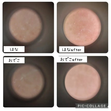 シカレチA エッセンス0.1/VT/美容液を使ったクチコミ(5枚目)