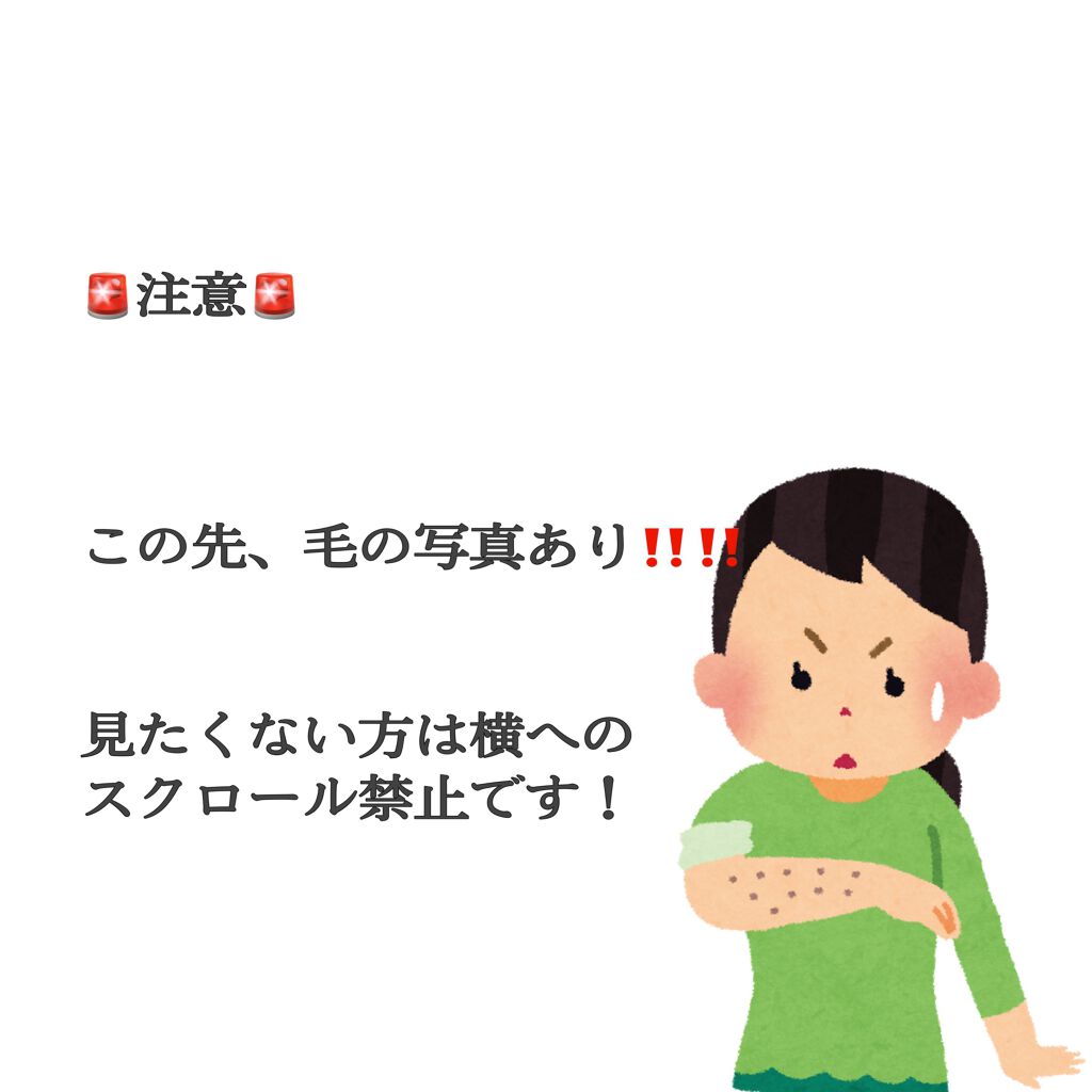 光美容器KE-NON(ケノン)/エムテック/家庭用脱毛器を使ったクチコミ(2枚目)