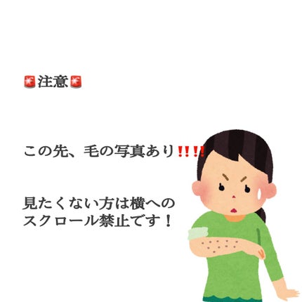 光美容器KE-NON(ケノン)/エムテック/家庭用脱毛器を使ったクチコミ(2枚目)