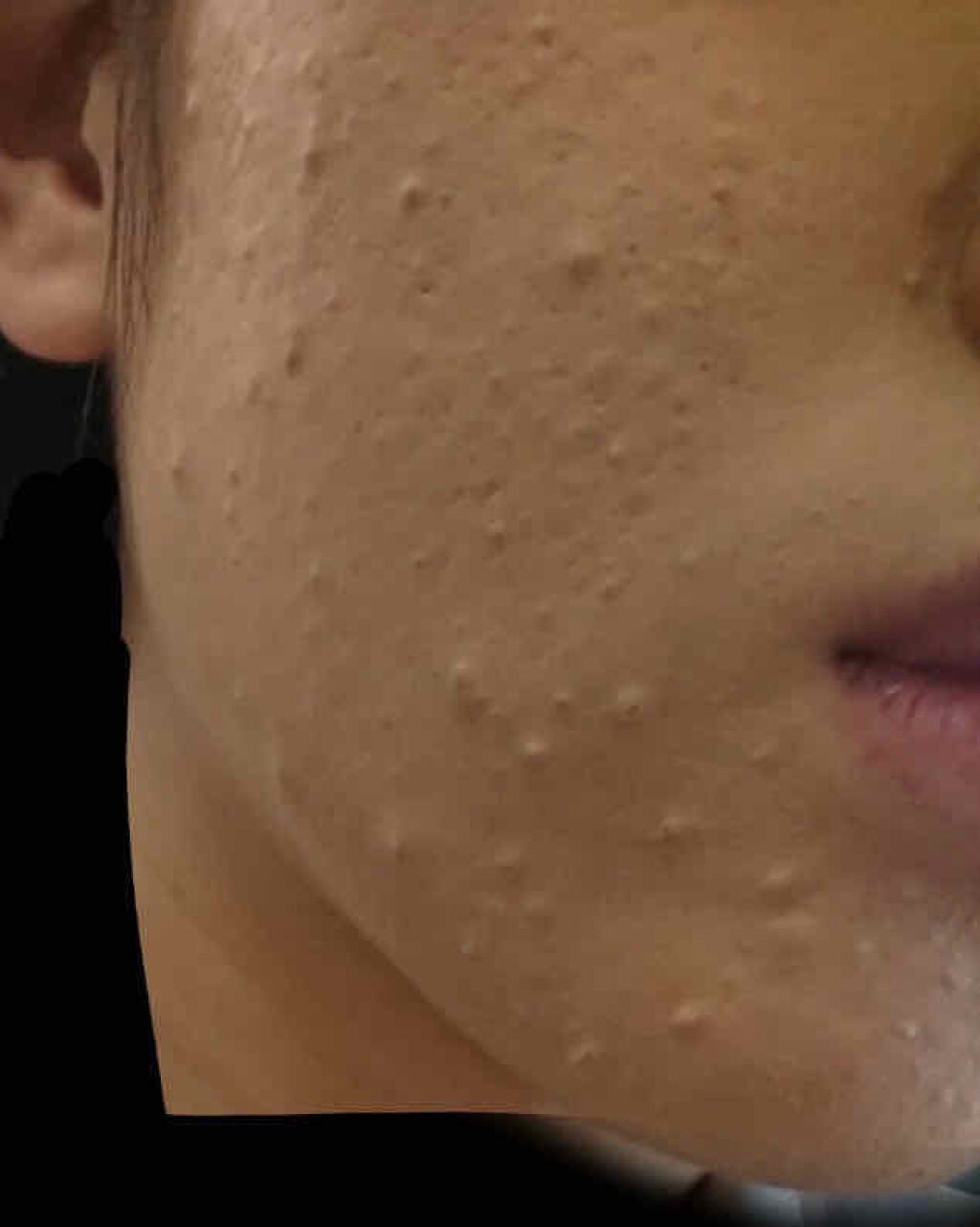 ぽんこ on LIPS 「こんにちは、ぽんこです!(閲覧注意です!!!)とりあえず、この..」(2枚目)