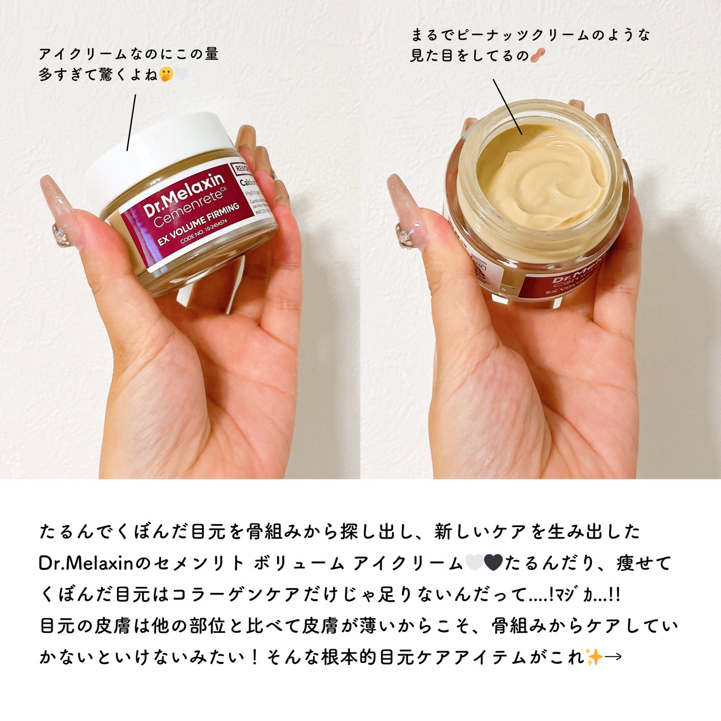 Cemenrete Calcium Intense Cream/Dr.Melaxin/フェイスクリームを使ったクチコミ(2枚目)