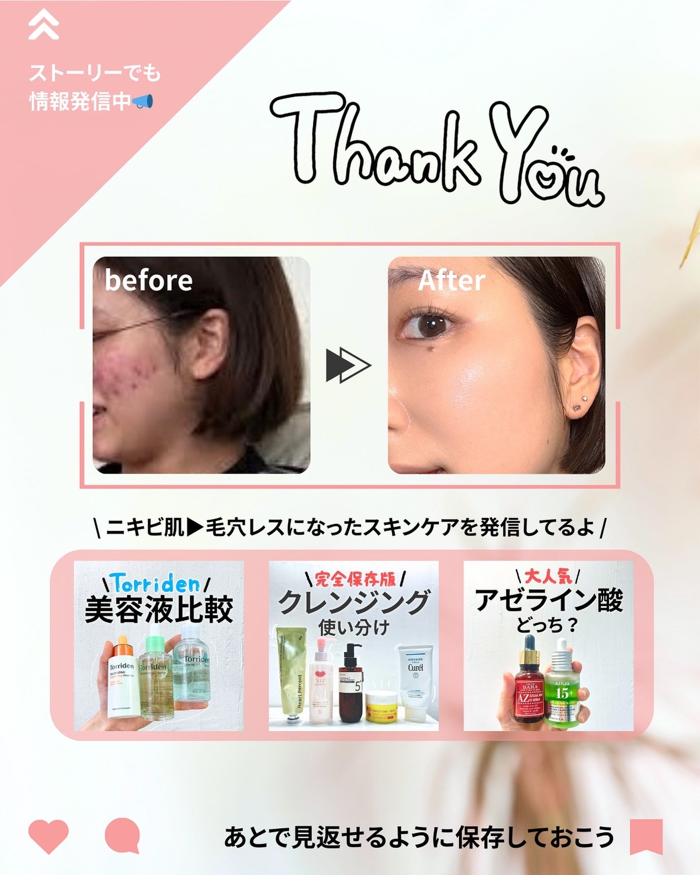 なぎ | スキンケア薬剤師 on LIPS 「◀︎ニキビ肌から毛穴レスになった薬剤師PDRNが丸わかり!👀こ..」(8枚目)
