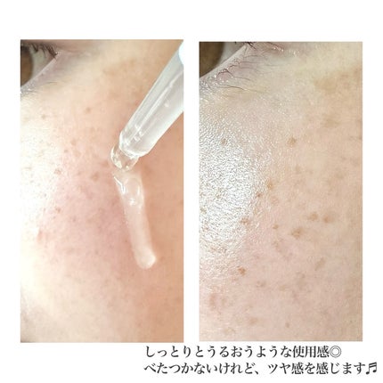 REJURAN デュアル エフェクト アンプル 30mL/REJURAN COSMETICS/美容液を使ったクチコミ(7枚目)
