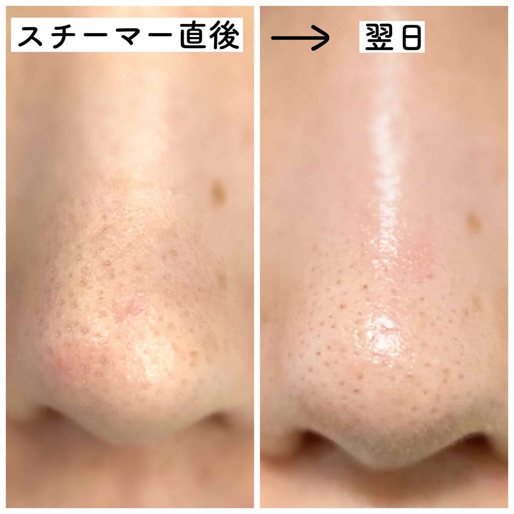 美ルル ウルミスト/belulu/美顔器・マッサージを使ったクチコミ(3枚目)