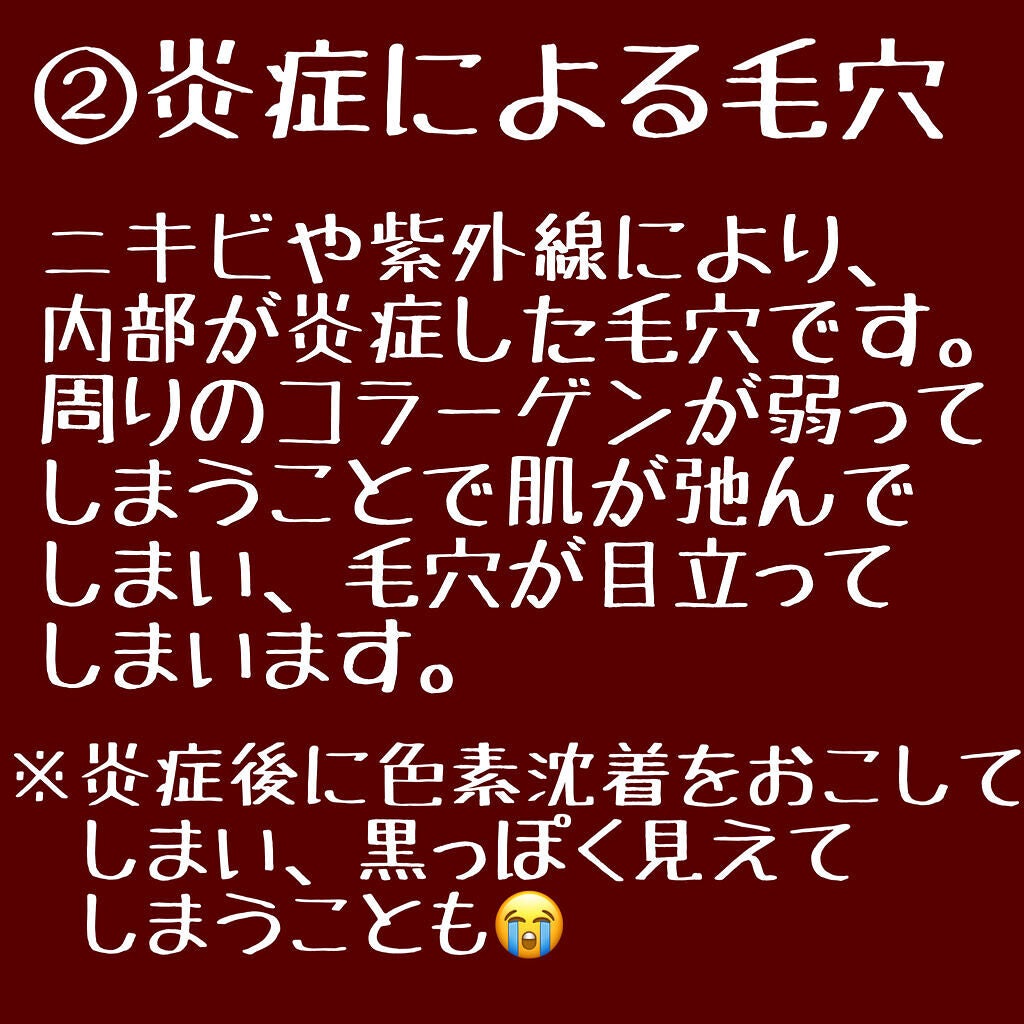 リアルカレンデュラピールオフパック/APRILSKIN/ピーリングを使ったクチコミ(3枚目)