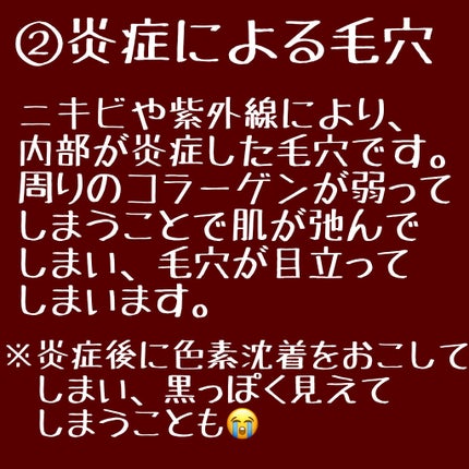 リアルカレンデュラピールオフパック/APRILSKIN/ピーリングを使ったクチコミ(3枚目)