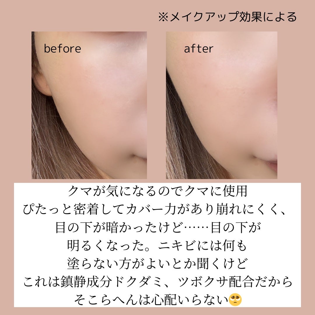 ダーマシンコンシーラー/23years old/リキッドコンシーラーを使ったクチコミ(3枚目)