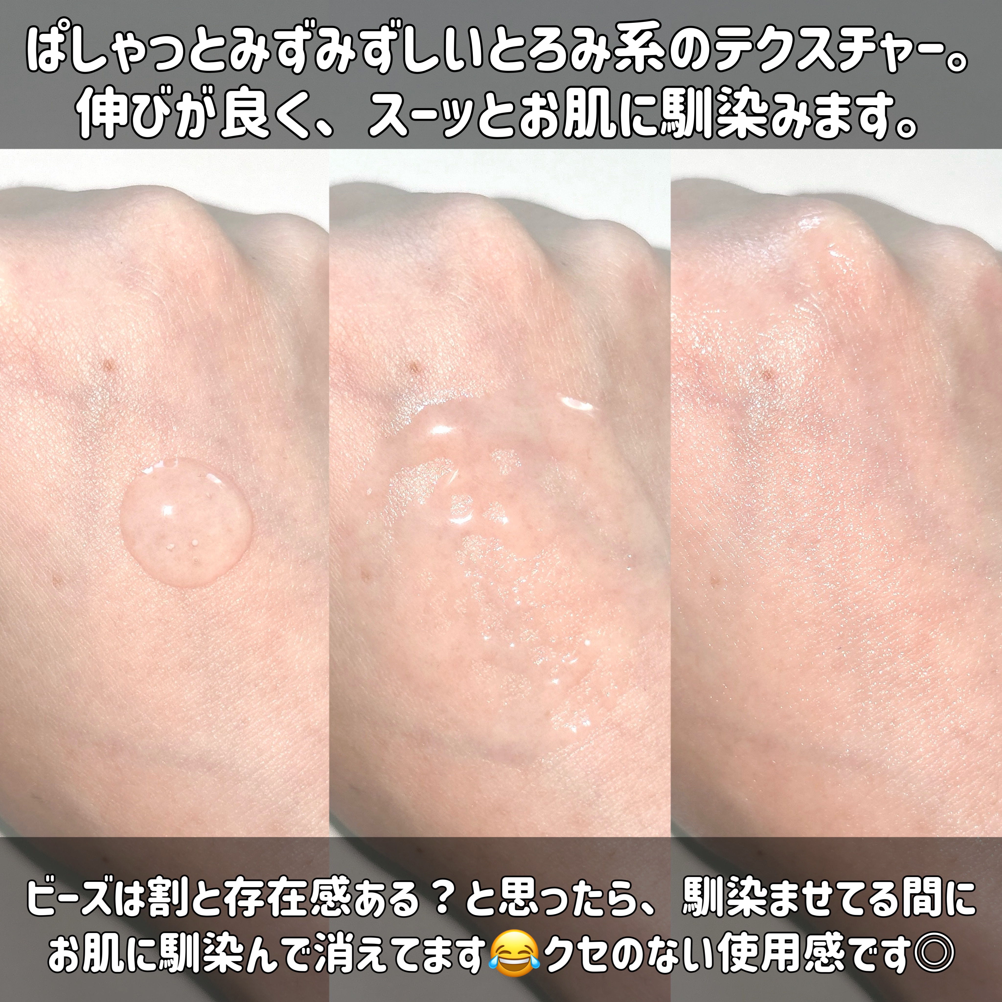 ナイアシンジンクビーズセラム/Frankly/美容液を使ったクチコミ（3枚目）