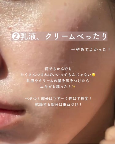 yuyu🐶肌荒れ体質の正直レビュー on LIPS 「【ニキビ跡ケア🔥やめてよかった6つのコト】✼••┈┈••✼••..」（3枚目）