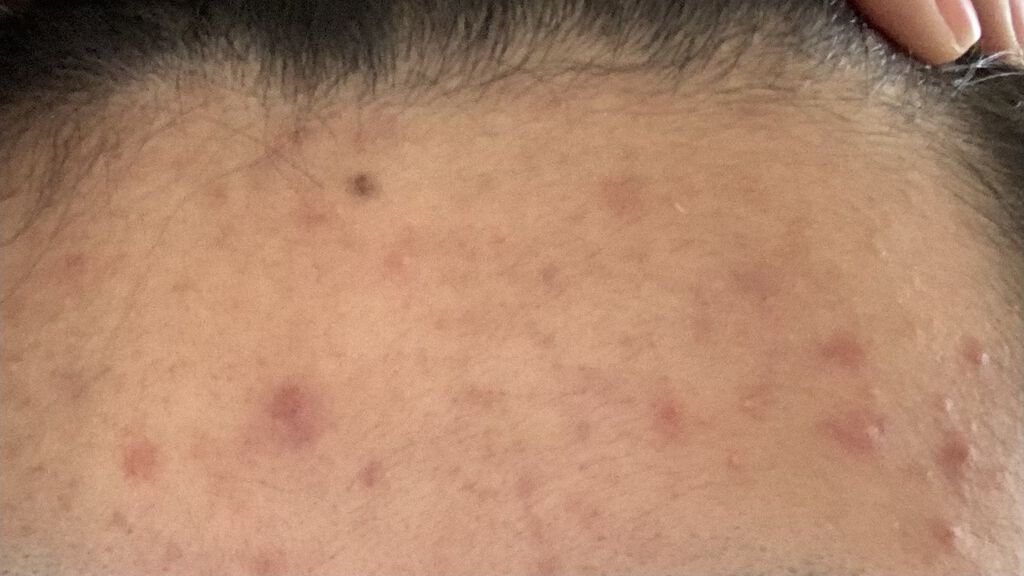 モイストミルク/WHOMEE/乳液を使ったクチコミ（3枚目）