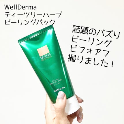 ティーツリーハーブピーリングパック/WellDerma/洗い流すパック・マスクを使ったクチコミ(1枚目)